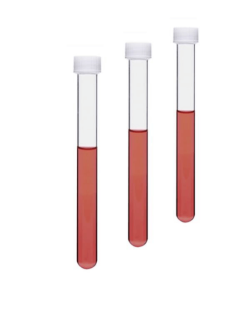 Tüp Deney dibi yuvarlak vida kapaklı 16*160 100 Adet